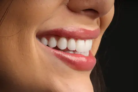 Sorriso transformado na CIOT