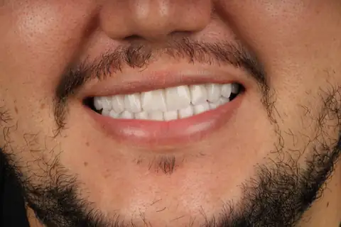 Sorriso transformado na CIOT